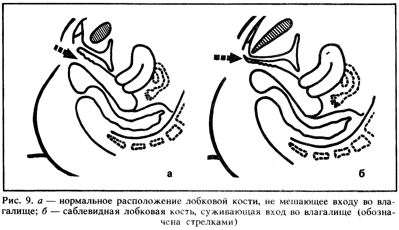 как член входит влагалище рисунок фото 80