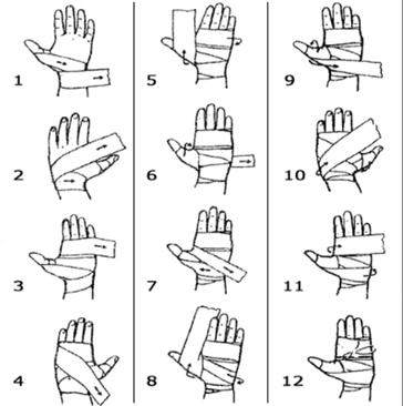 Бинтование рук в боксе схема