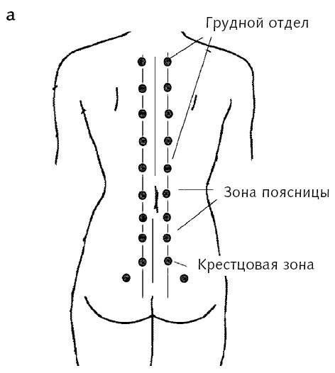 Схема банок на спине расстановки