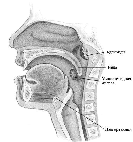 Надгортанник. Эпиглоттит надгортанник. Носоглотка надгортанник. Воспаление надгортанника.