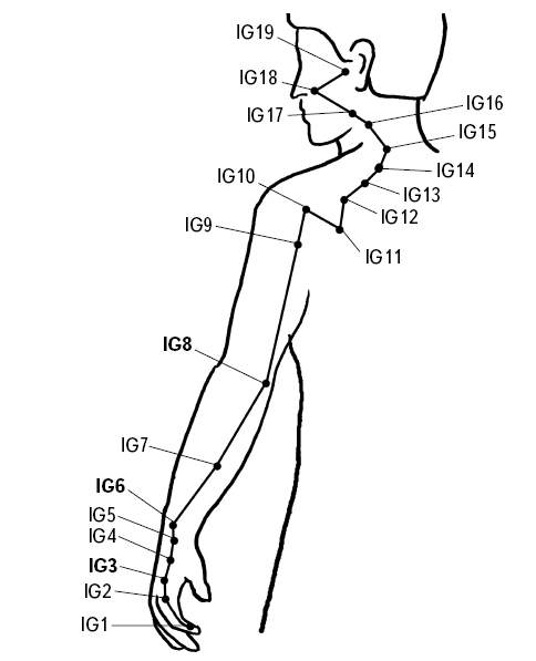 Ig x 2. Точка Цзянь-Чжун-Шу. Ig6 точка акупунктуры. Цзянь Чжэнь точка. Чжи Чжэн точка акупунктуры.