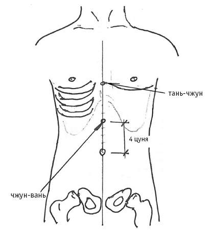 Точка вс 12. Точка vc12 Чжун-Вань. Точка Чжун Вань акупунктуры. VC-12 Чжун-Вань. Чжун Вань точка расположение.
